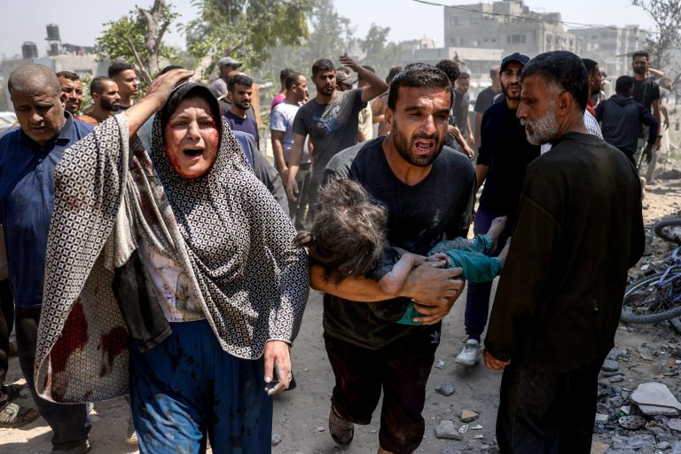 EDITORS NOTE: Graphic content / A Palestinian woman reacts as a man carries an injured child pulled from the rubble of the Shaheen family home, that was targeted in an Israeli strike in the Saftawi neighbourhood, west of Jabalia, in the northern Gaza Strip on June 9, 2025. (Photo by BASHAR TALEB / AFP)